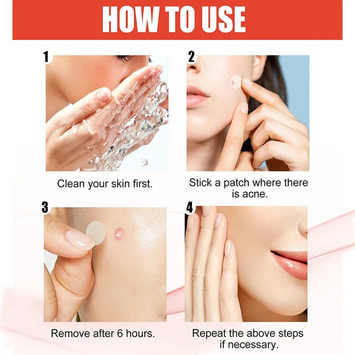 Pimple Remover Patch (36 Patches in 1 Pack)